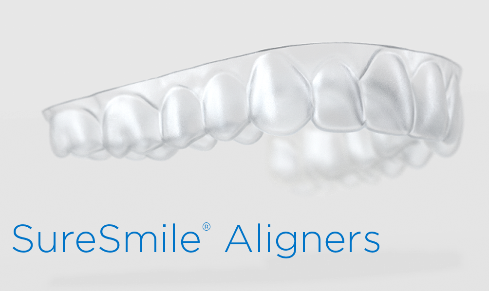 Discover Your Dream Smile with SureSmile