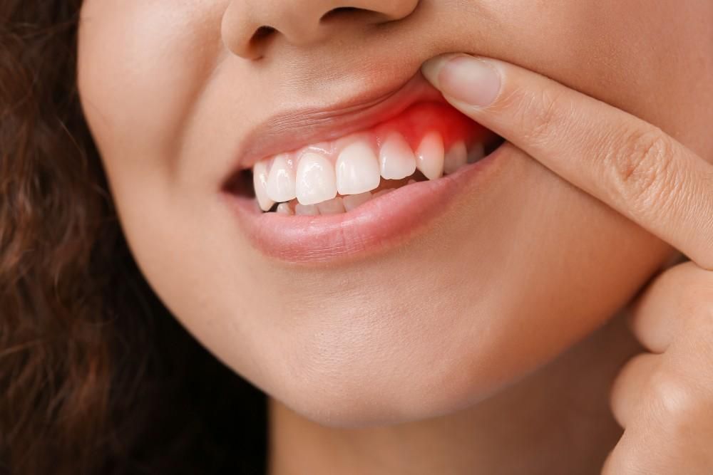 dental treatment at Restora Dental Arts Austin Texas