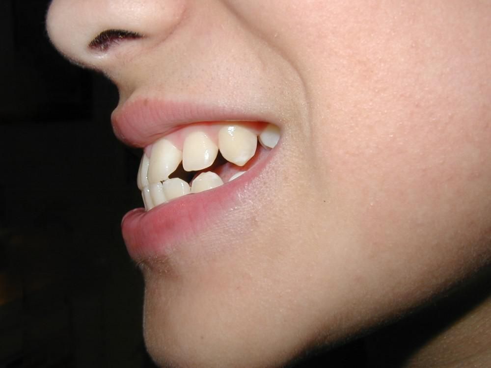 Dental Treatment at Restora Dental Arts Austin Texas