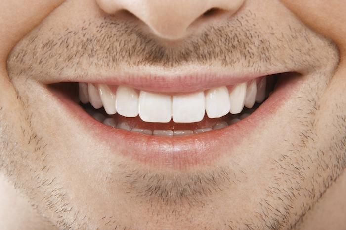 Dental Treatment at Restora Dental Arts Austin Texas